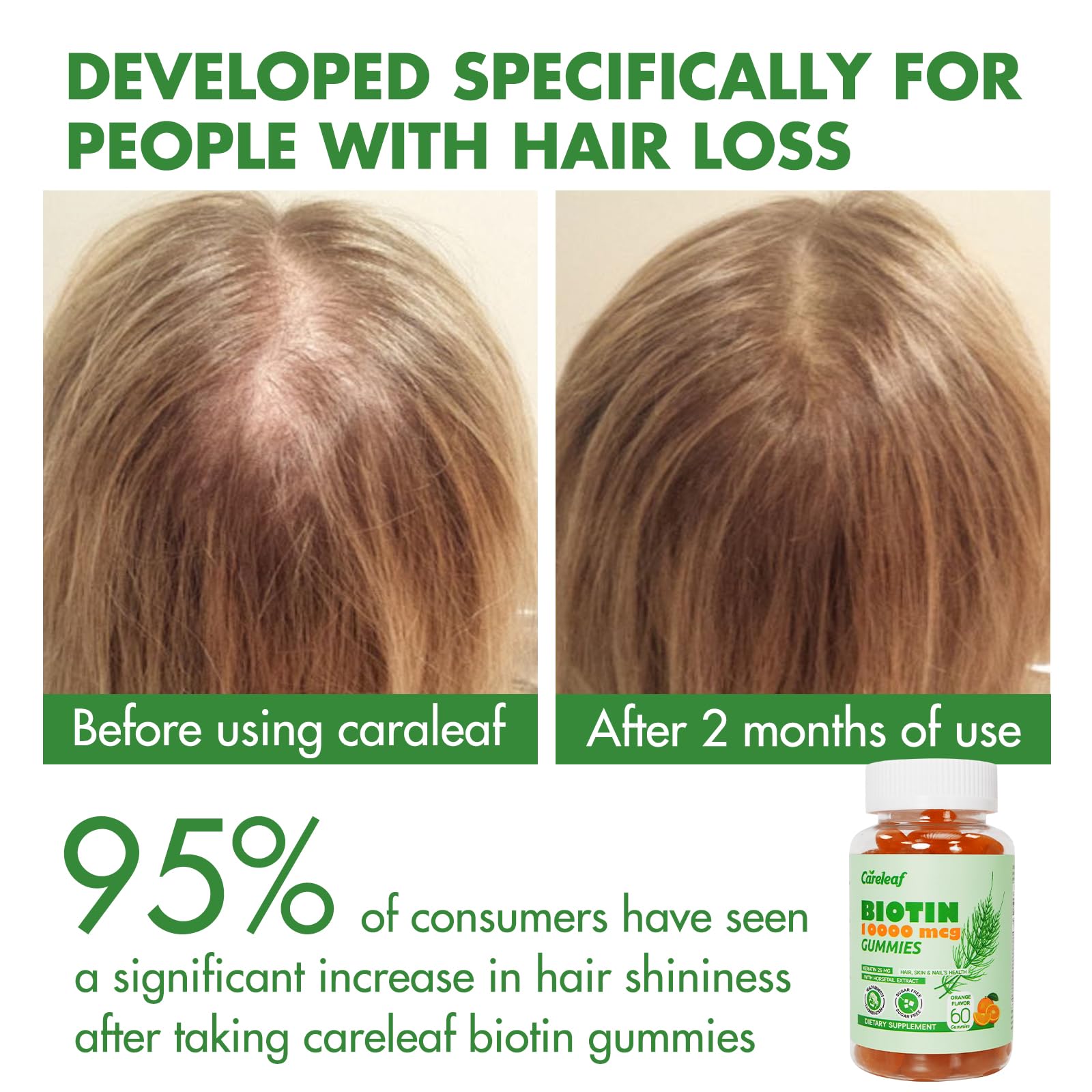 Illustration of hair growth with keratin and collagen