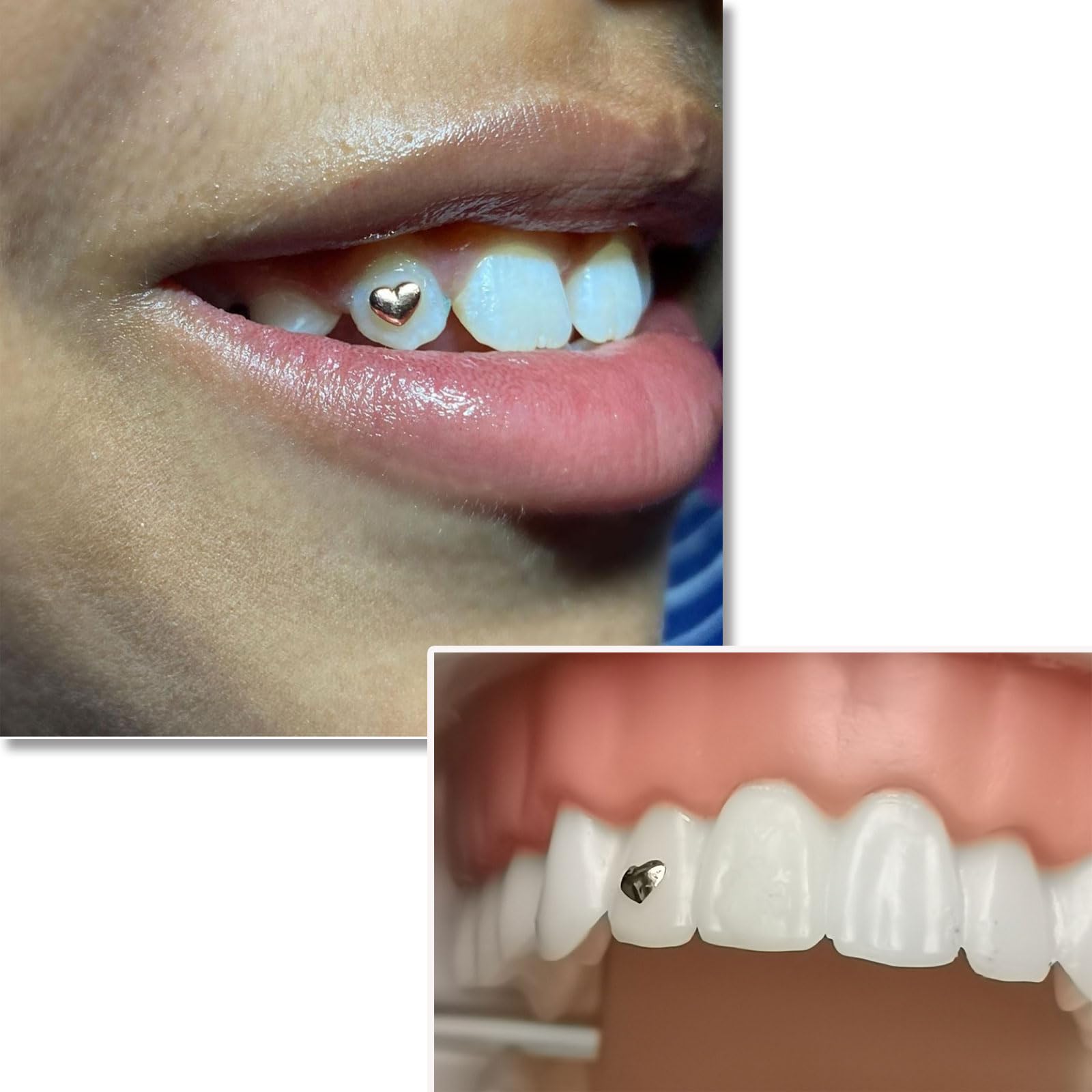 Gold rhombus tooth gem shape