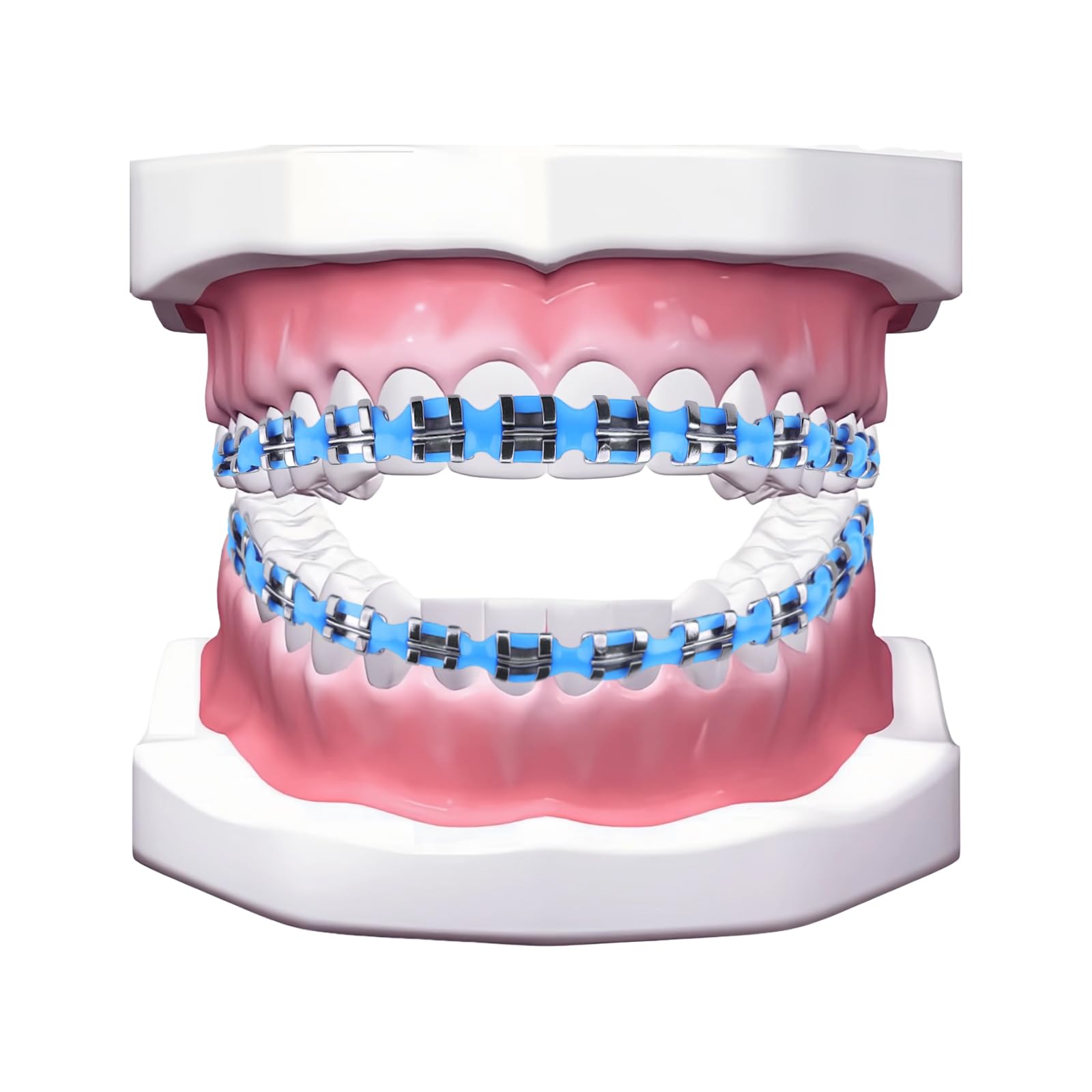 Orthodontic teaching demonstration using clip-on braces.