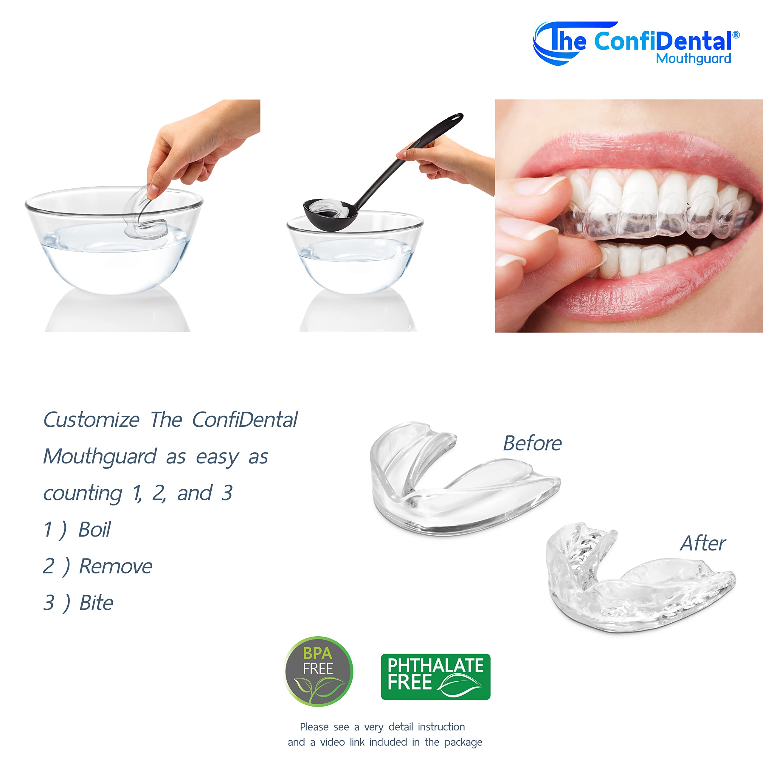 ConfiDental mouth guard used as whitening tray with whitening gel