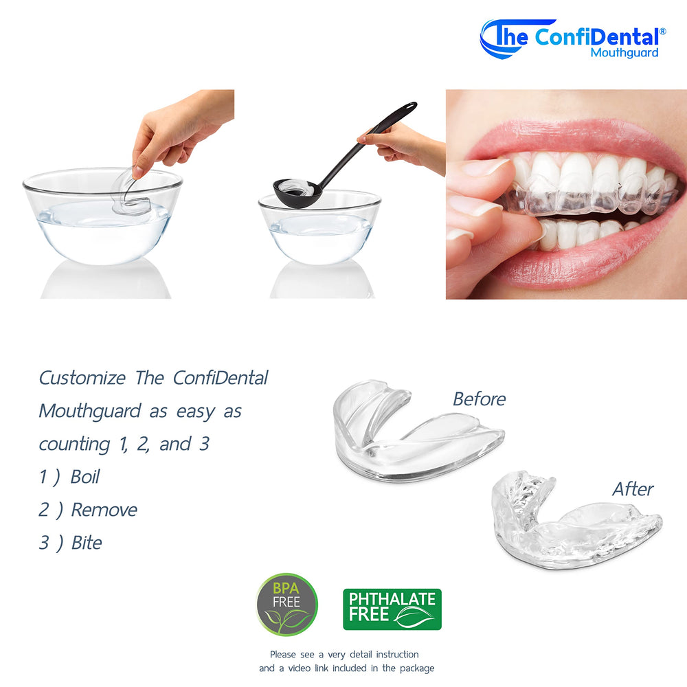 ConfiDental mouth guard used as whitening tray with whitening gel
