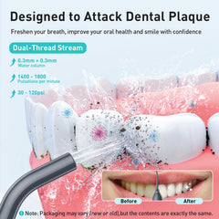 Rechargeable cordless water flosser with 300ml tank