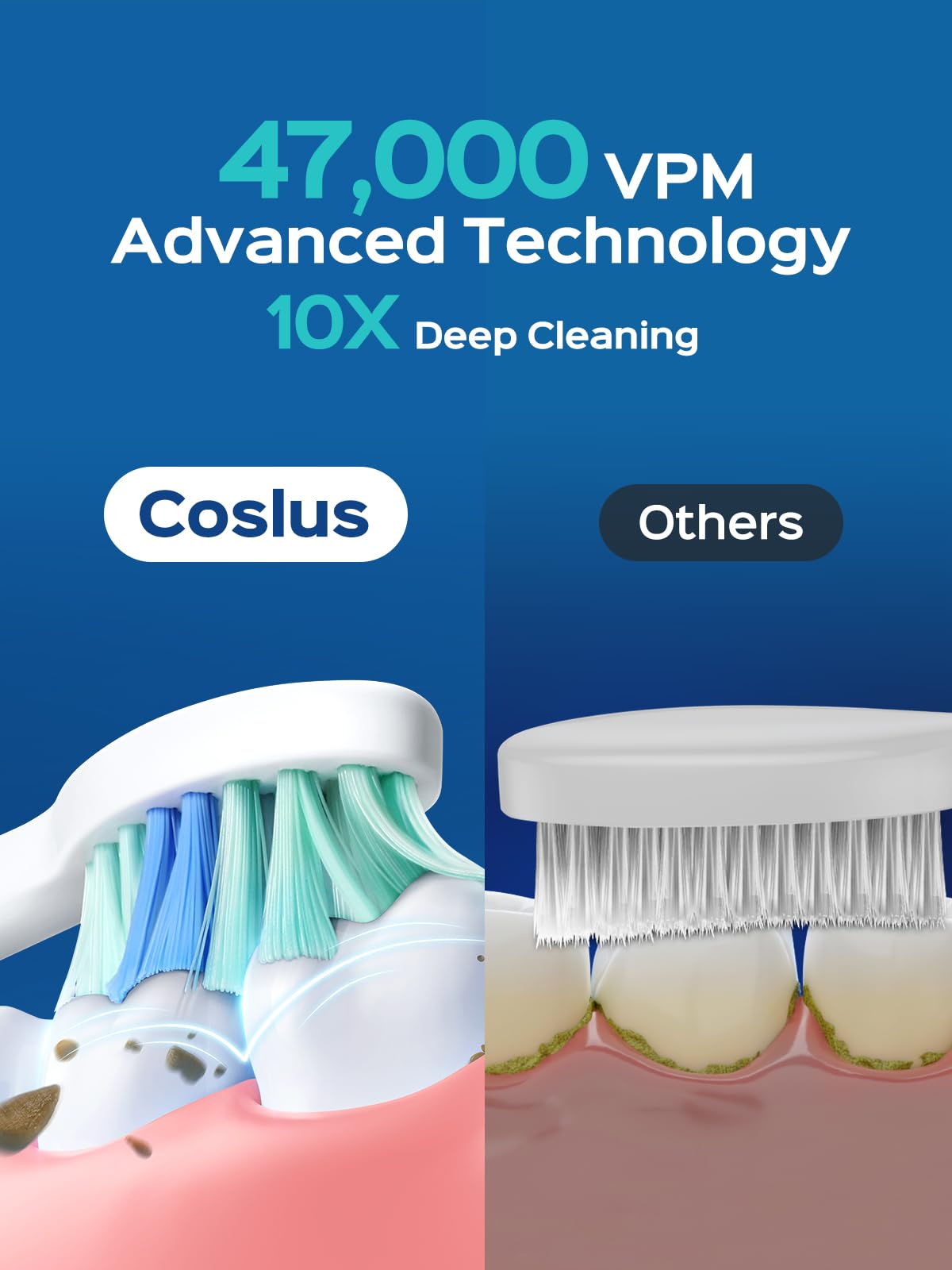 Illustration of 47,000 VPM deep cleaning with COSLUS flosser