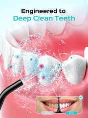 COSLUS water flosser being used with braces to show orthodontic cleaning
