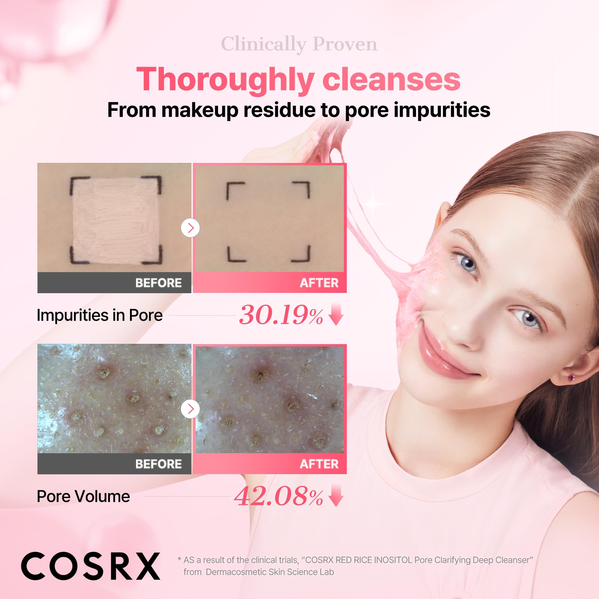 COSRX cleanser in palm to show volume and thickness for usage clarity