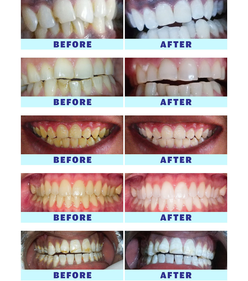 User manual and packaging for Crystal Clear Teeth Whitening Kit