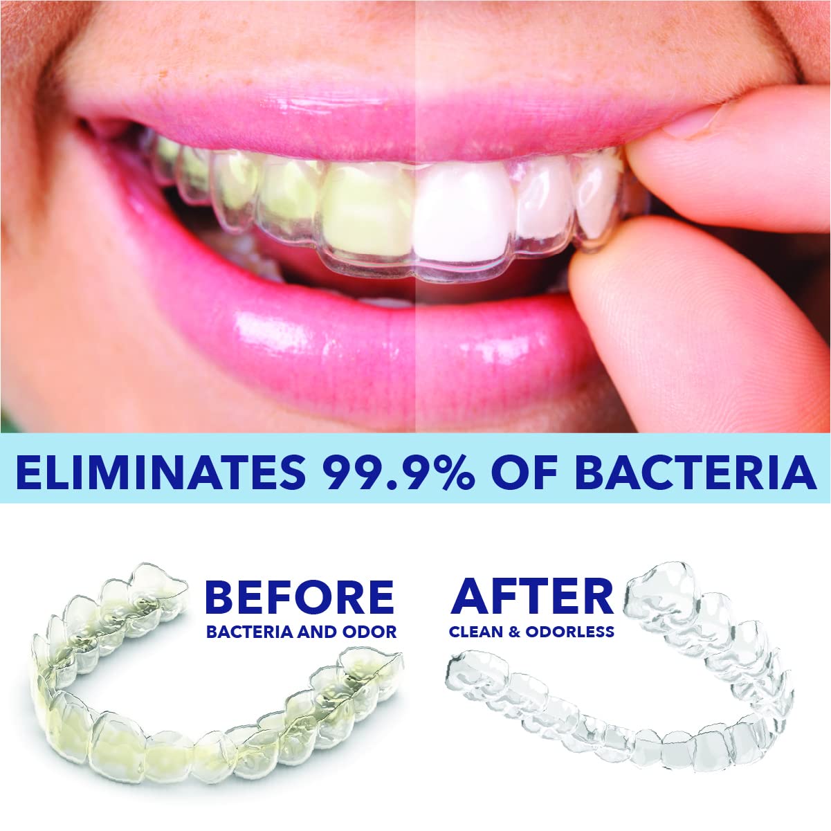 Usage: spray cleaner on dentures or retainers