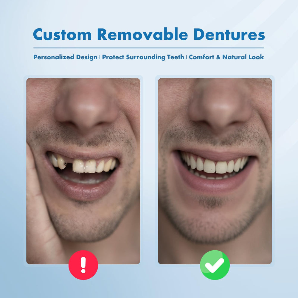 Dentures fitting securely in place for single or multiple missing teeth
