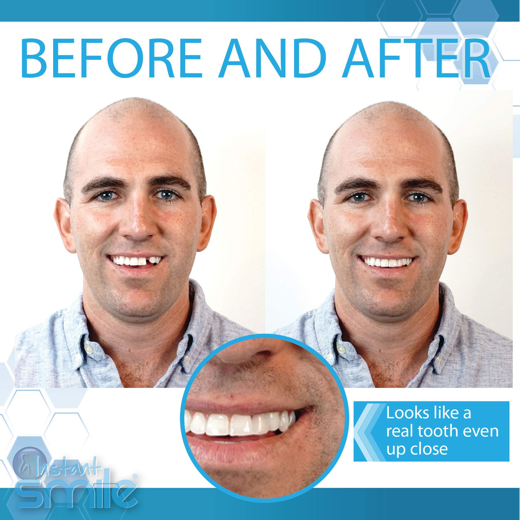 Assorted customizable teeth showing shade options