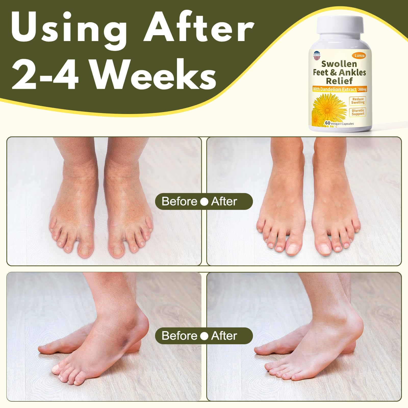 260mg Dandelion Leaf Extract as a natural diuretic