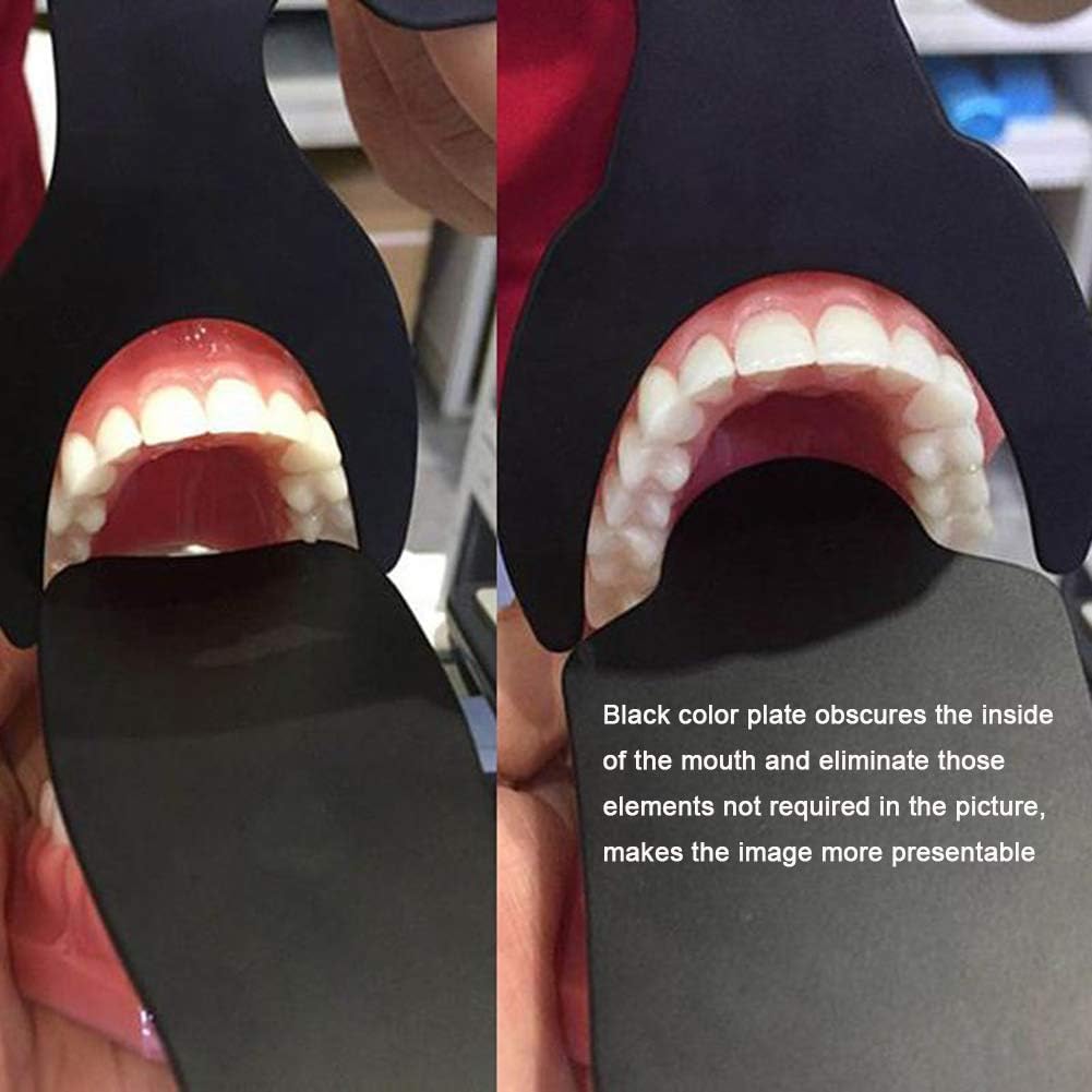 Set of palatal and standard boards laid out for intraoral photography