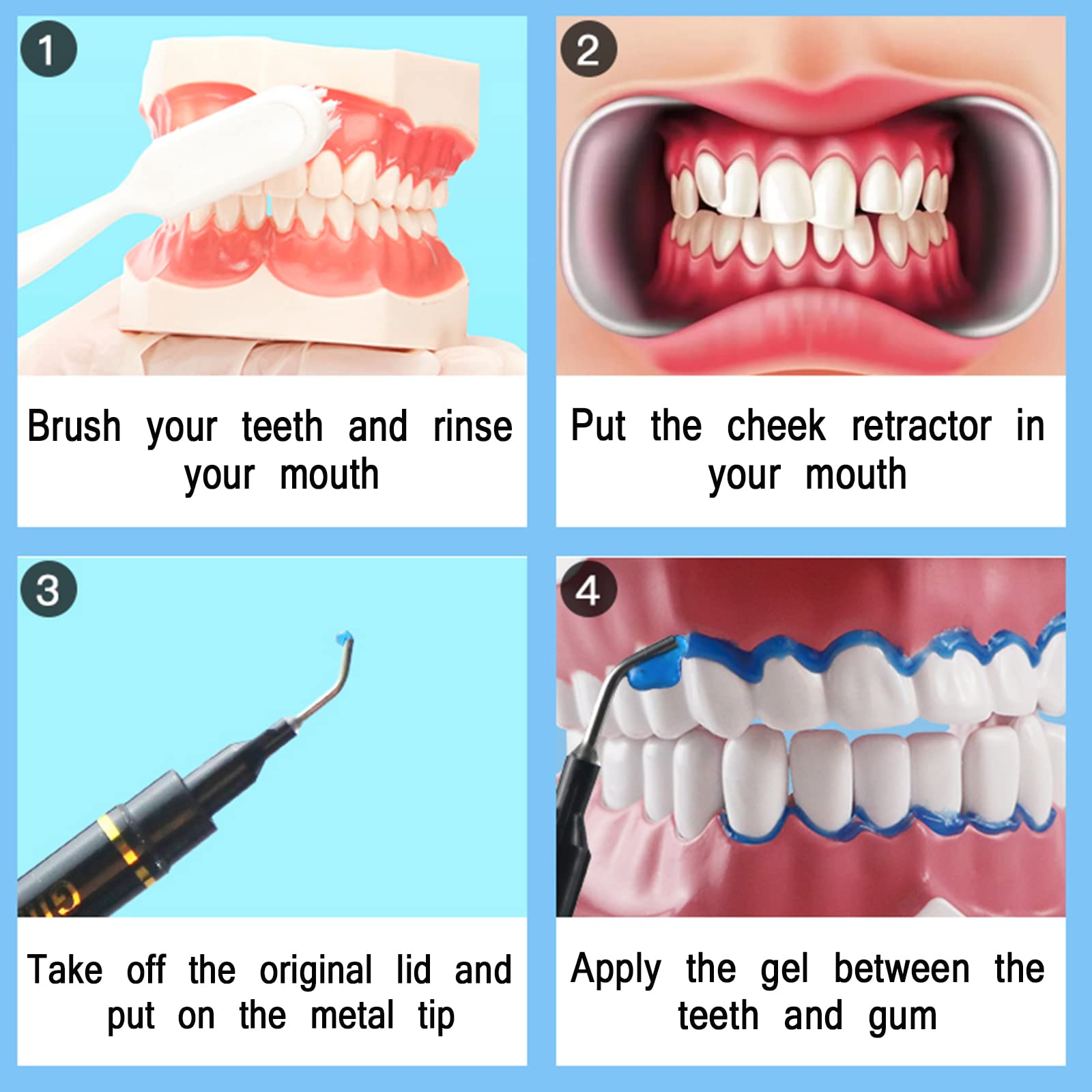 Gingival protection gel applied to gums during teeth whitening
