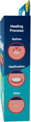 Mint-flavored canker sore tablets in blister pack