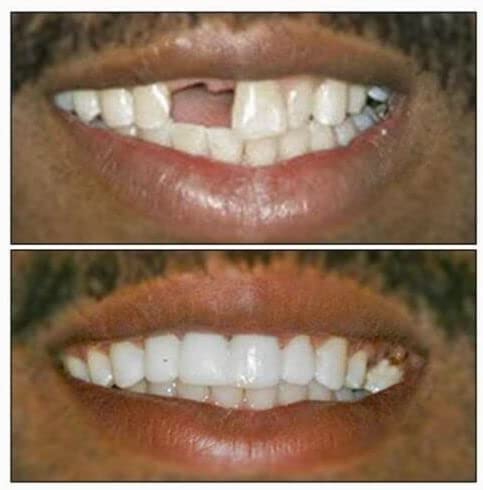 Dentemp brand logo and 30+ years of dental experience
