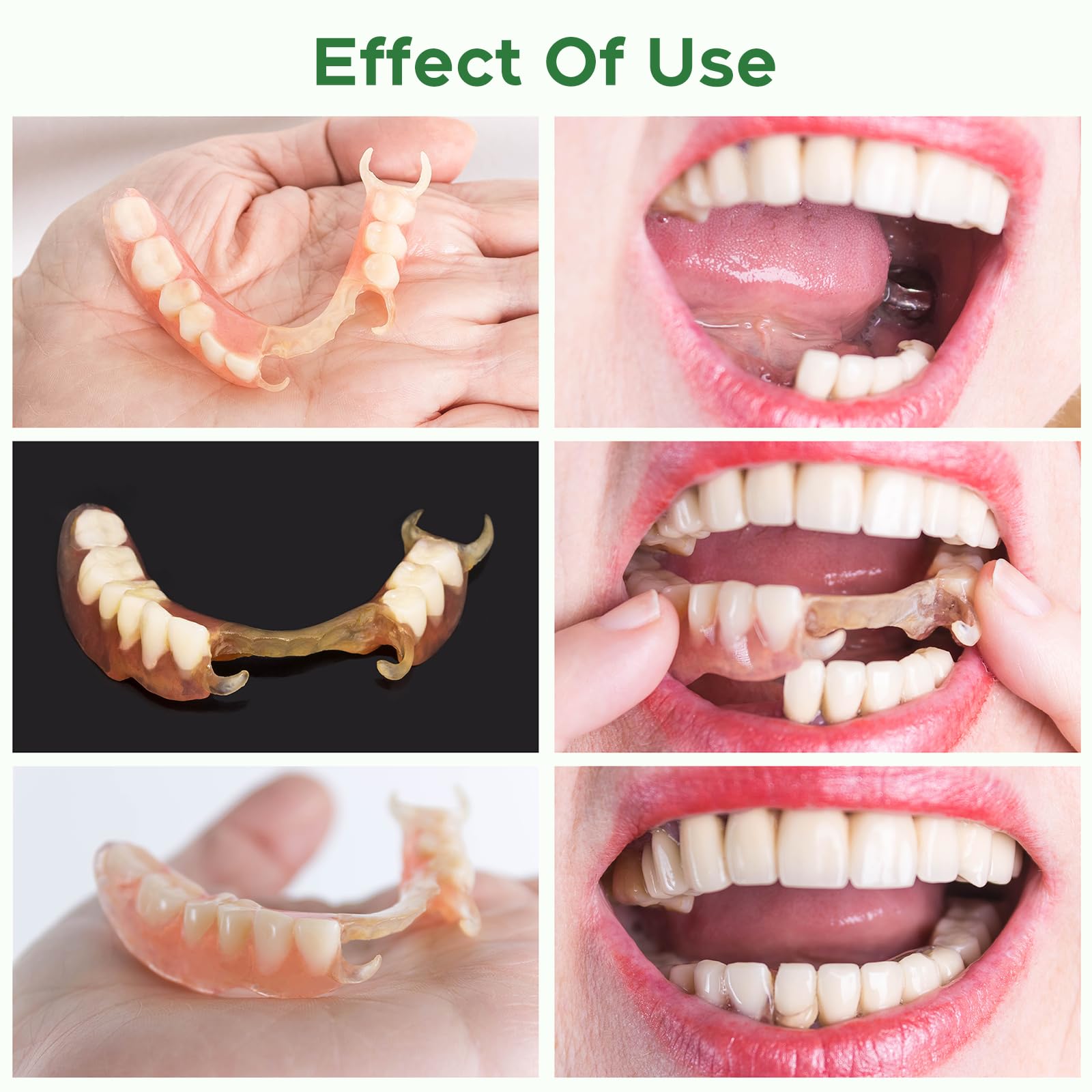 Dentures color-stable and resistant to yellowing