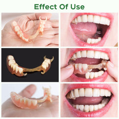 Dentures color-stable and resistant to yellowing