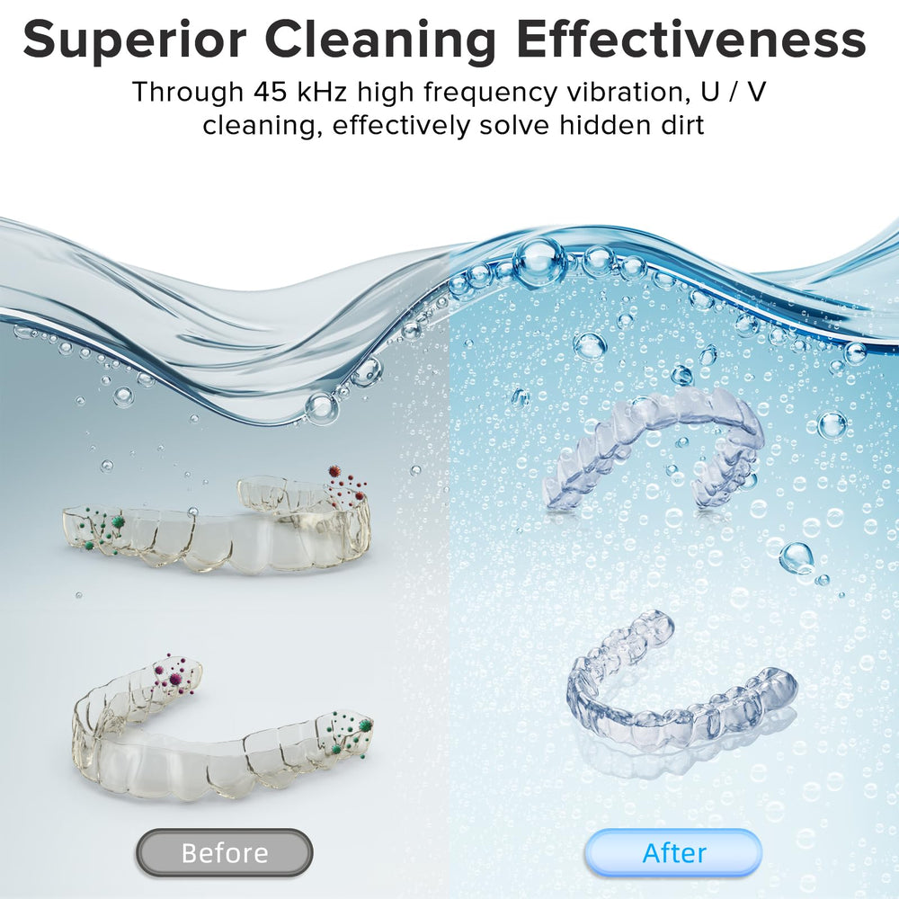 Cleaning dentures, aligners and mouth guards in ultrasonic cleaner