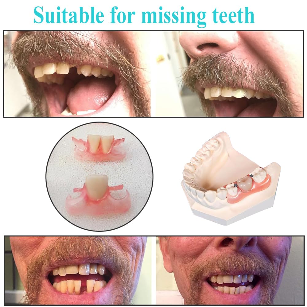 Inside view of dentures DIY kit with moldable materials