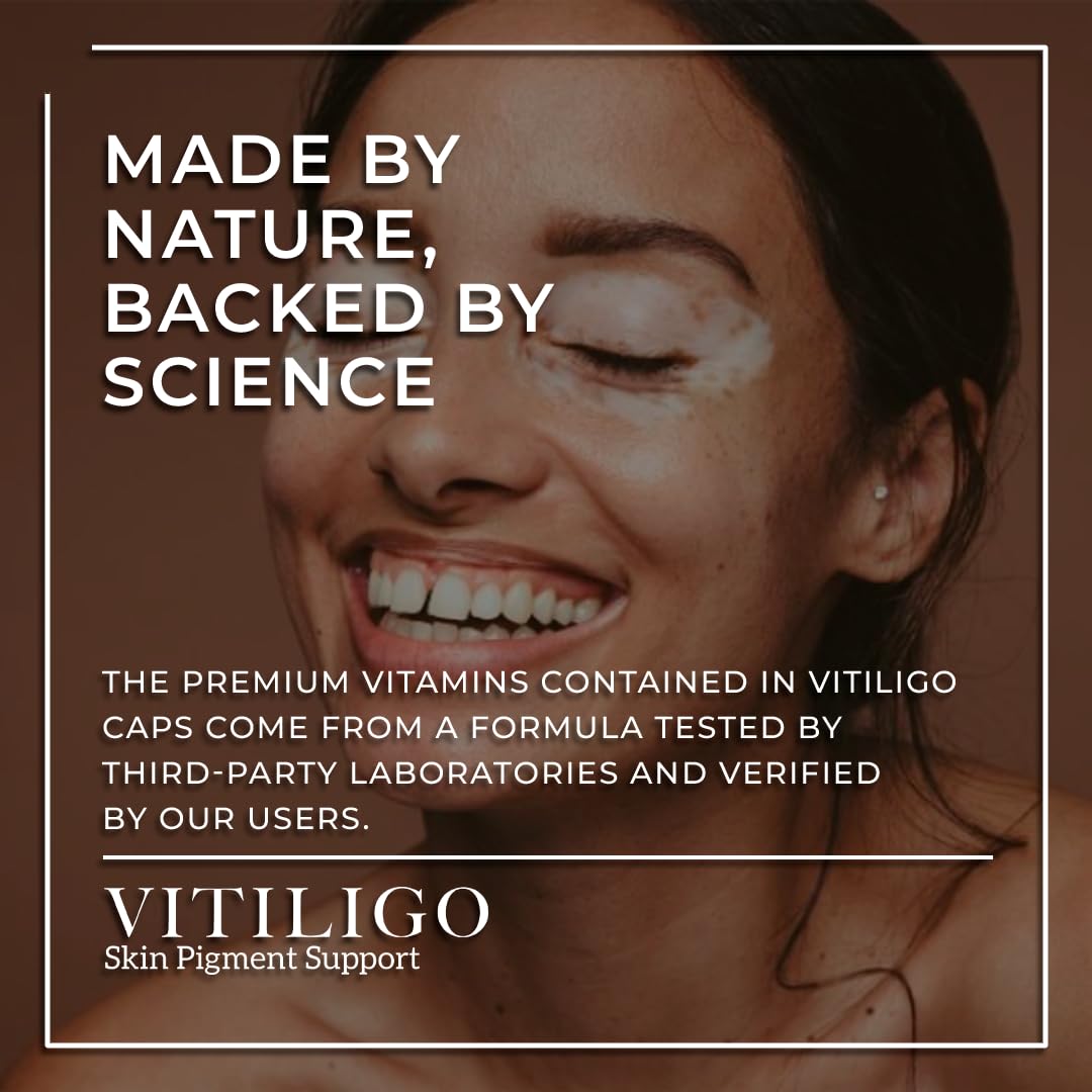 Label view of Dermawonder Vitiligo Capsules 60 Count