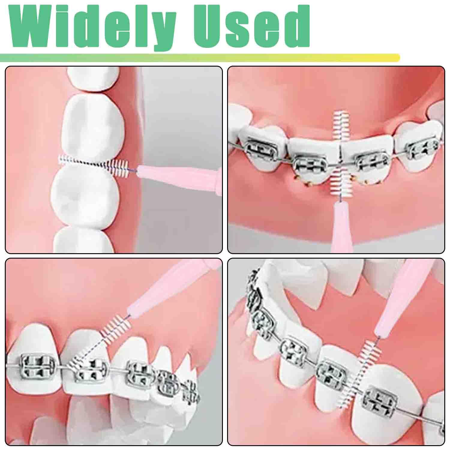 Interdental brushes cleaning tight spaces between teeth