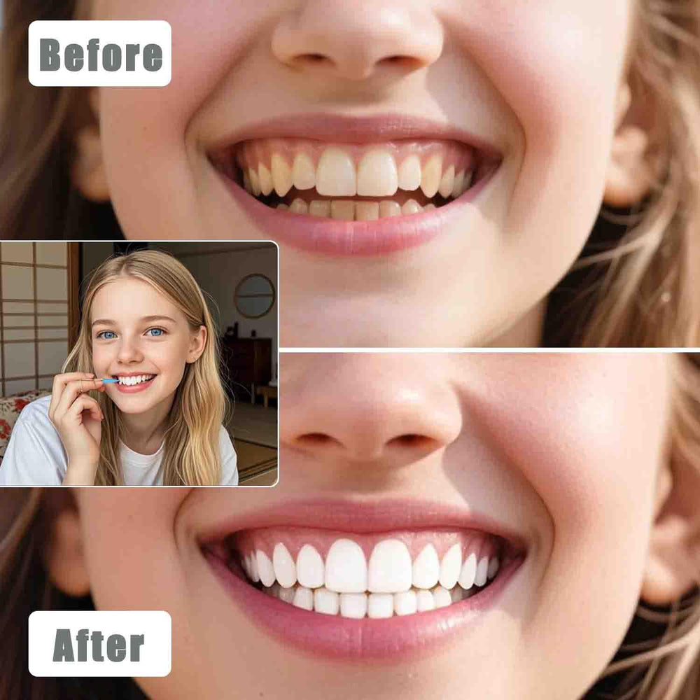 Interdental brushes removing stains between teeth