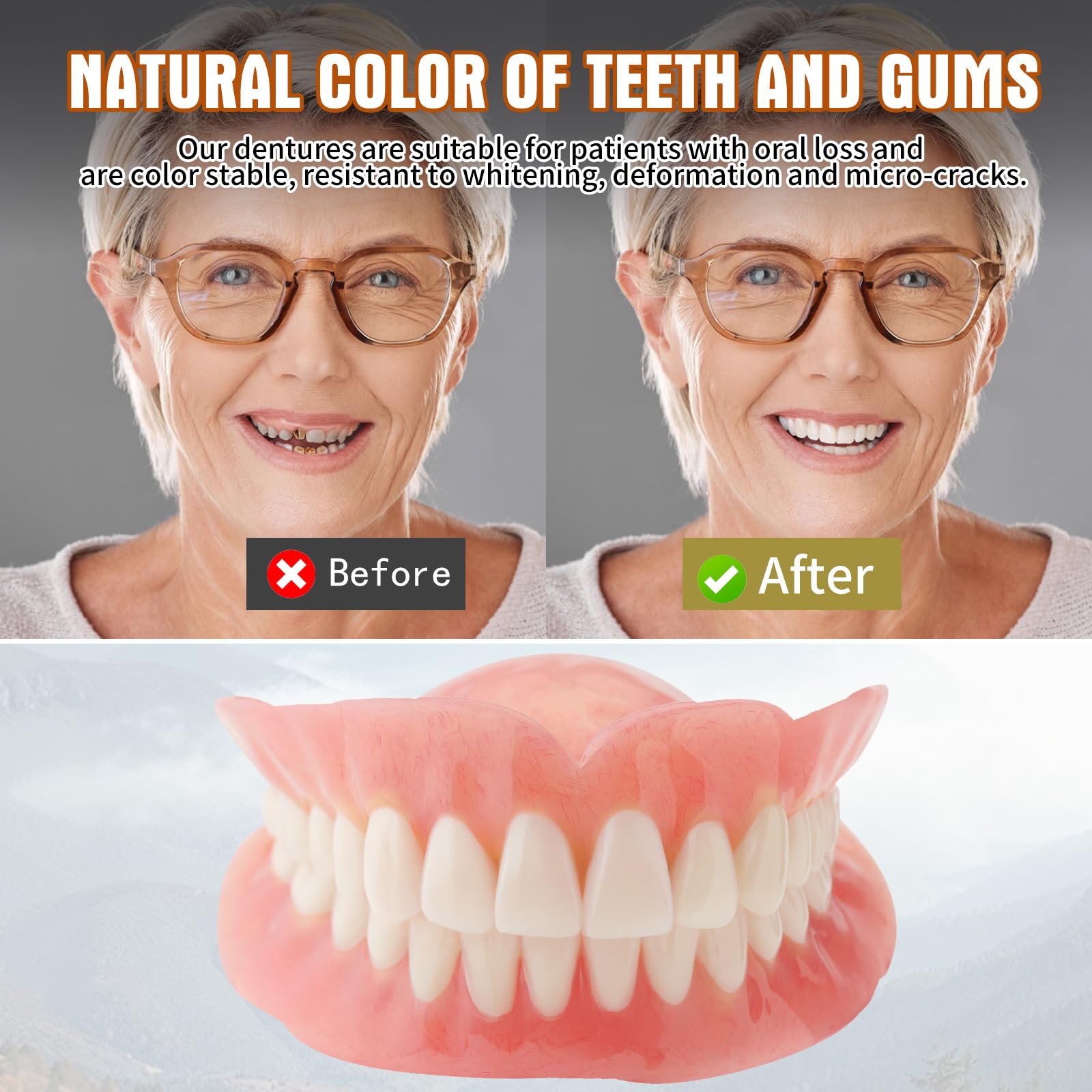 Dianww denture kit packaging and components