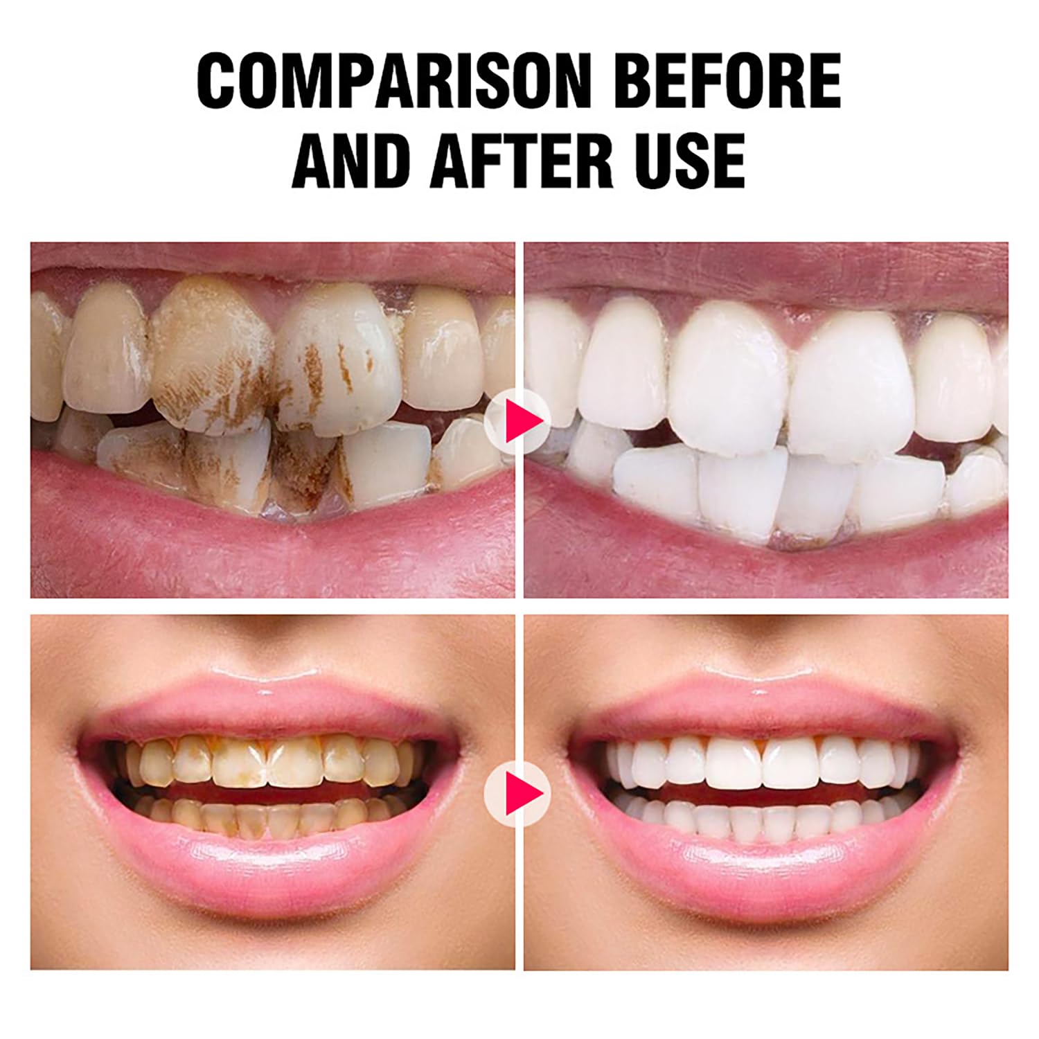 Tooth powder compatible with dental restorations like crowns or veneers