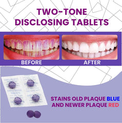 Two-tone red and blue plaque-disclosing stains on teeth