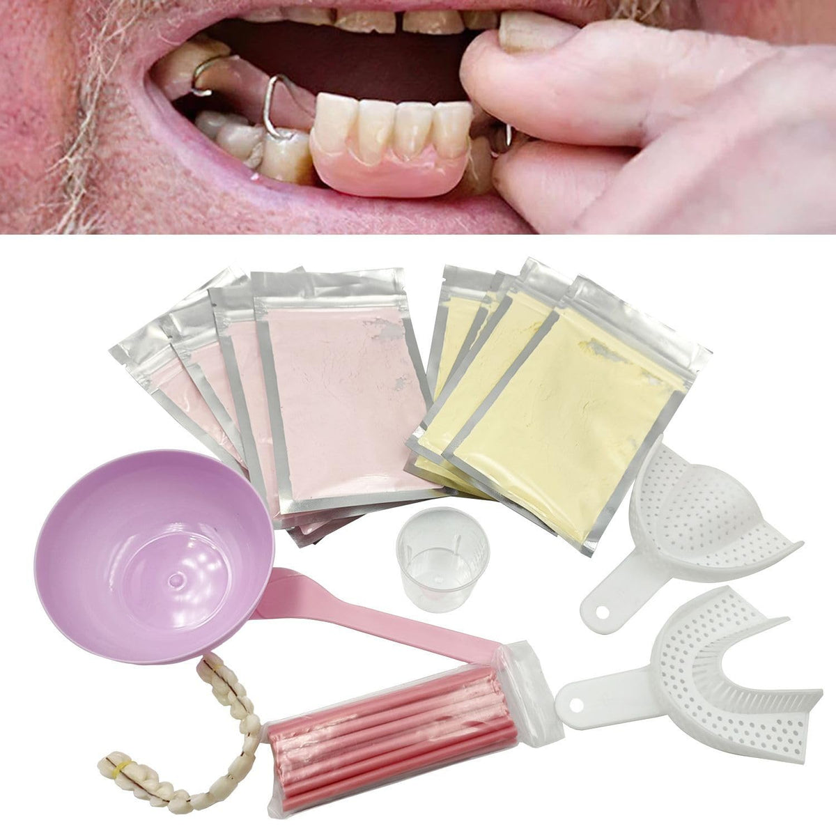 DIY Denture Kit cover image