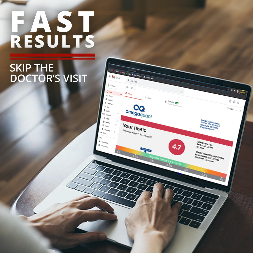 Prepaid shipping label and return envelope