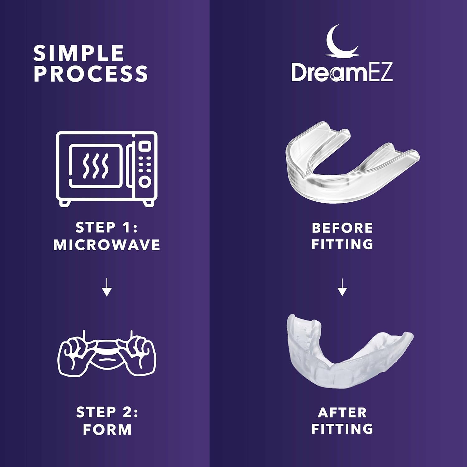 DreamEZ night guard being molded for a custom fit