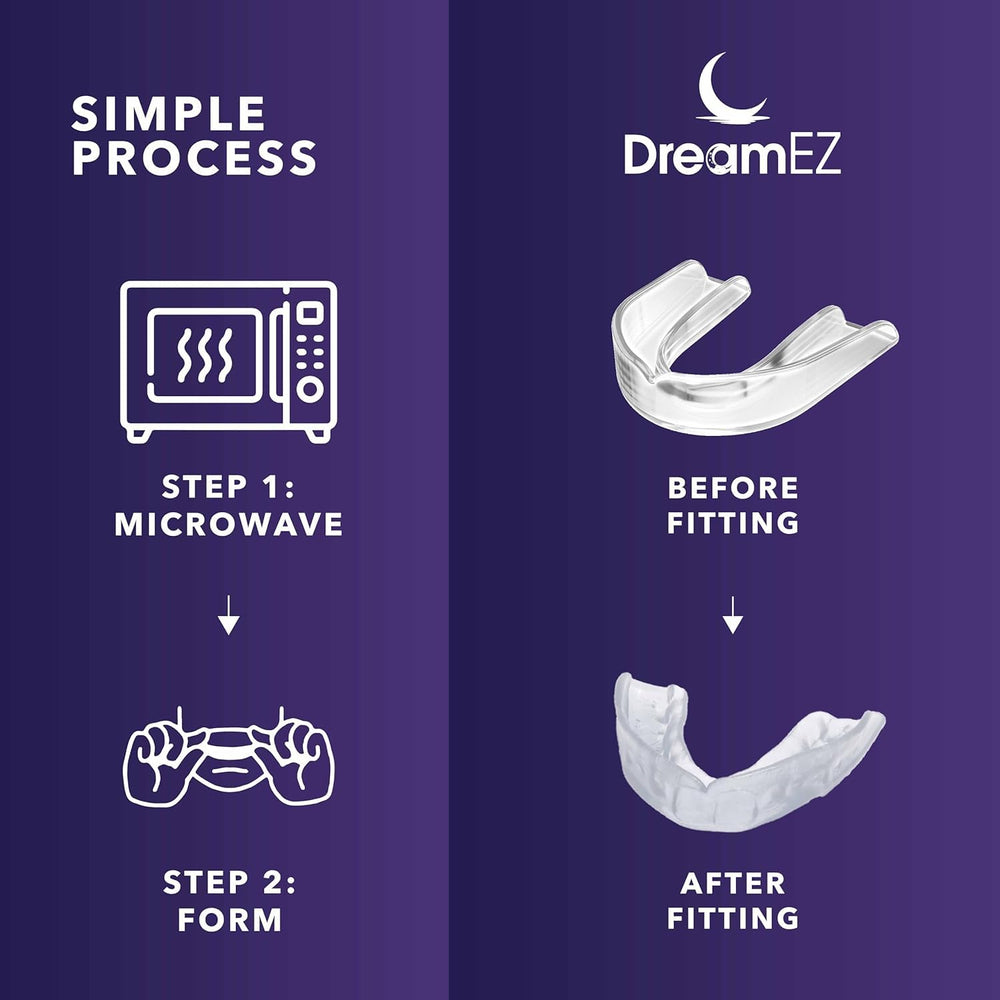 DreamEZ night guard being molded for a custom fit