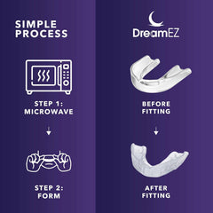 DreamEZ night guard being molded for a custom fit