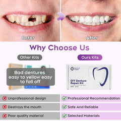 Easy smile repair with DIY denture kit