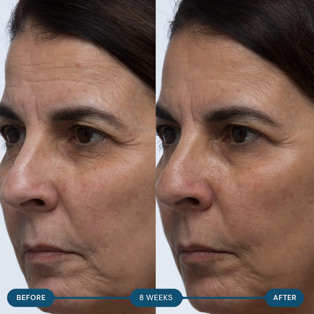 Hyaluronic acid illustration representing hydration support for ELEMIS