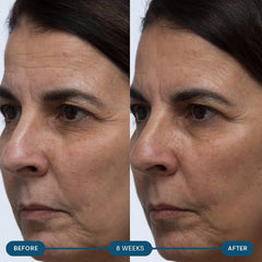 Hyaluronic acid illustration representing hydration support for ELEMIS