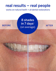 Enamel-safe whitening strips on display