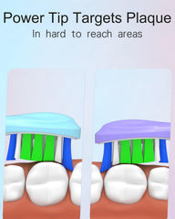 Close-up of end-rounded nylon bristles