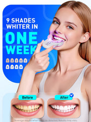 Ergonomic U-shaped whitening tray for comfortable wear