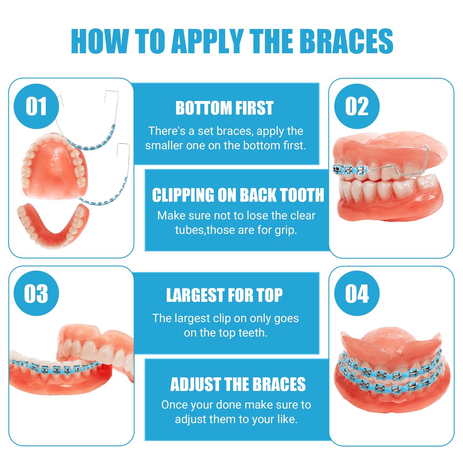 Fake braces kit ready to install on an orthodontic dental mold.