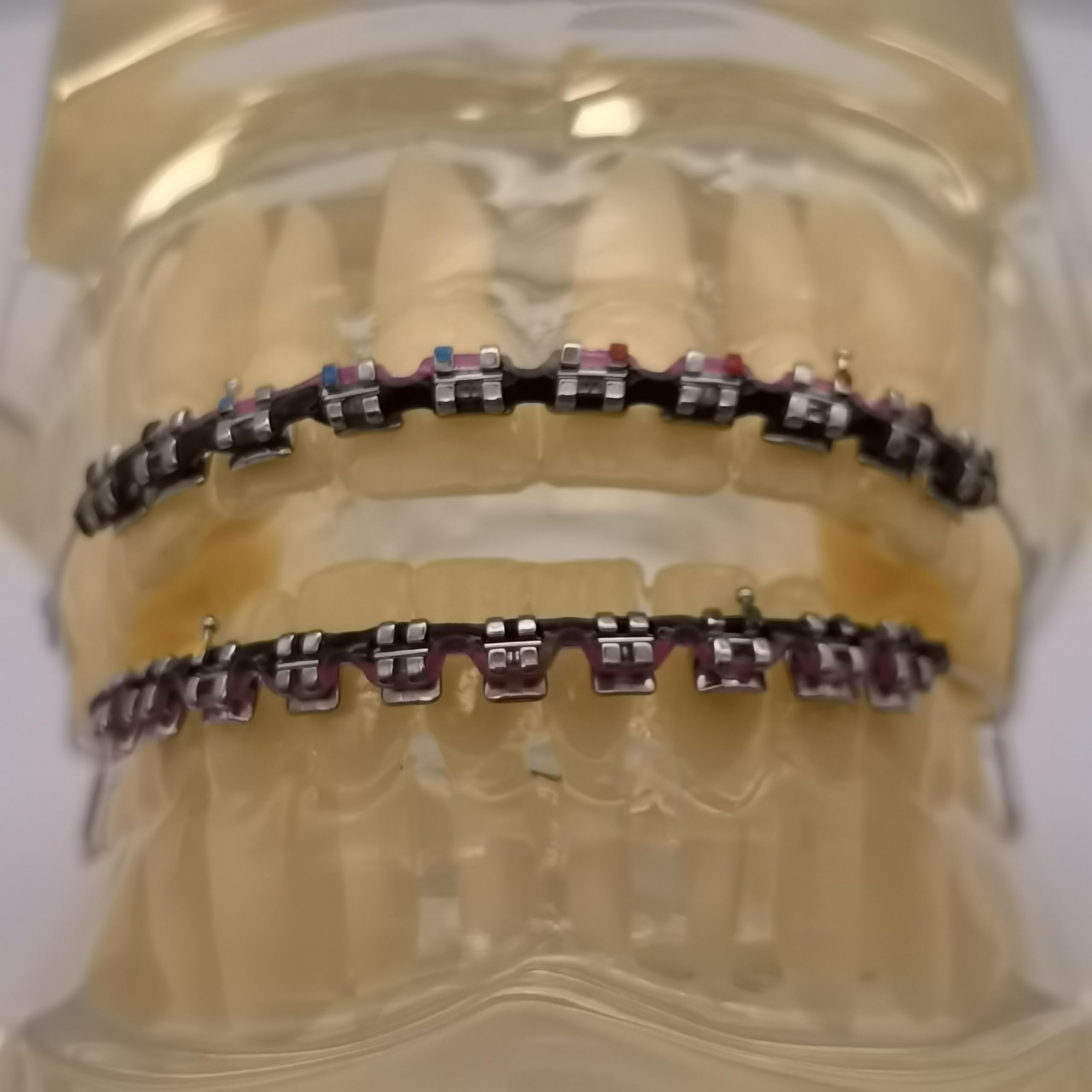 Close-up of two-color braces power chains in No.61 kit