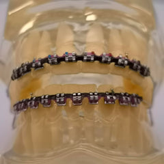 Close-up of two-color braces power chains in No.61 kit