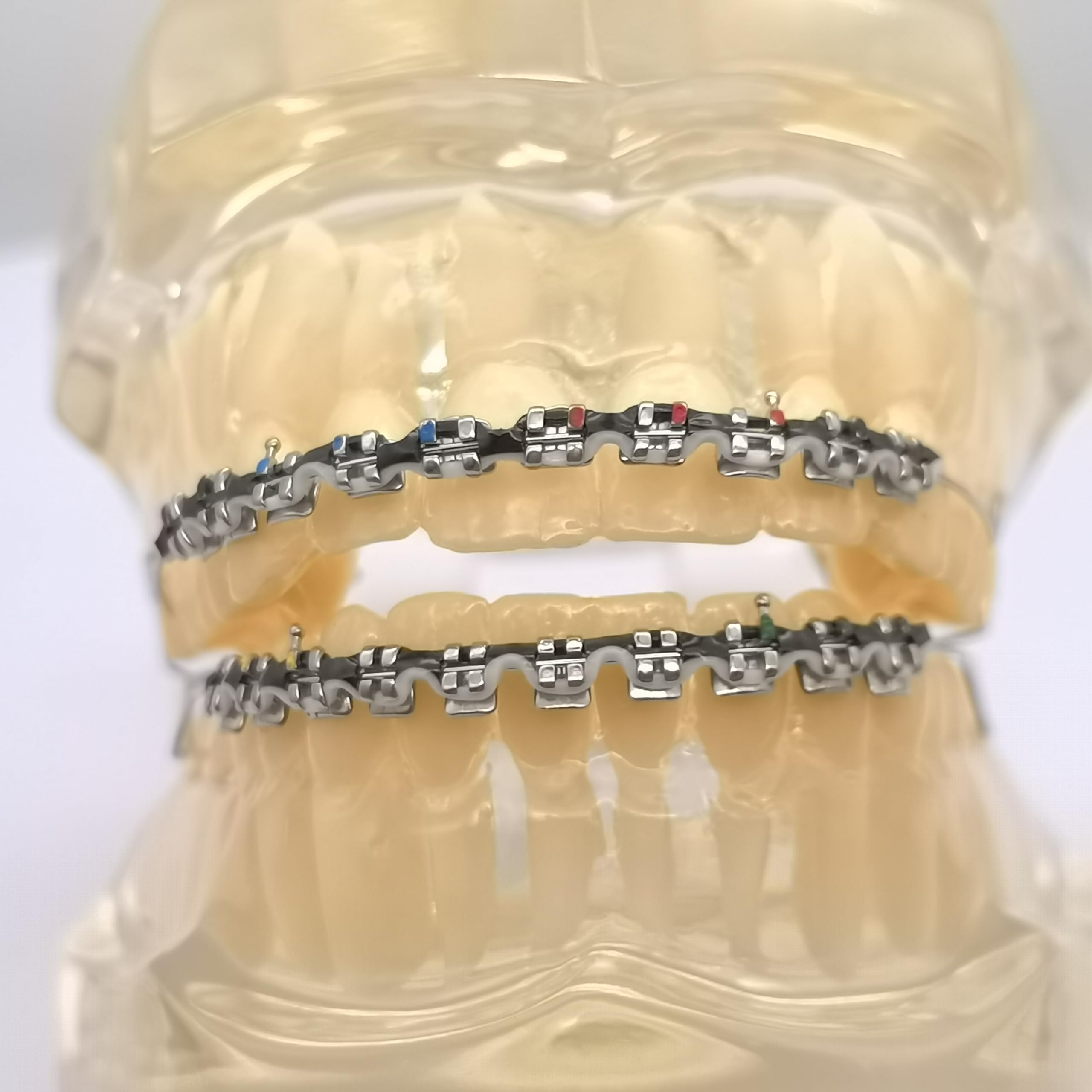 Close-up of metal bracket and wire in fake braces kit