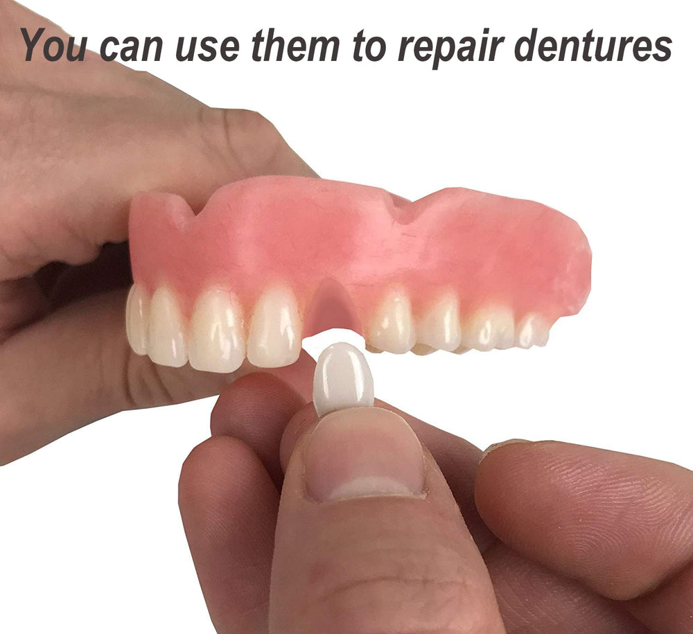 Gum filling support for natural look and confident smile