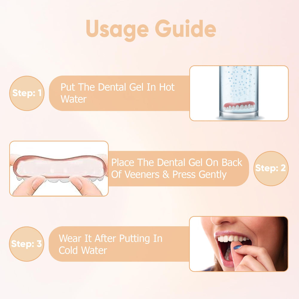 Soft, natural look of SmileShaperVeneers on gums