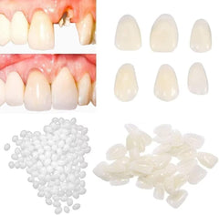Womcare fake tooth repair kit with moldable beads and false tooth model