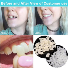 Close-up of moldable thermal beads used for tooth replacement