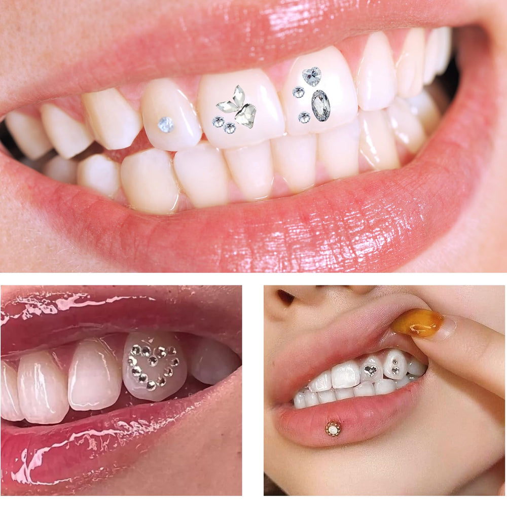 Sparkling smile featuring Fiorland Tooth Gems Kit