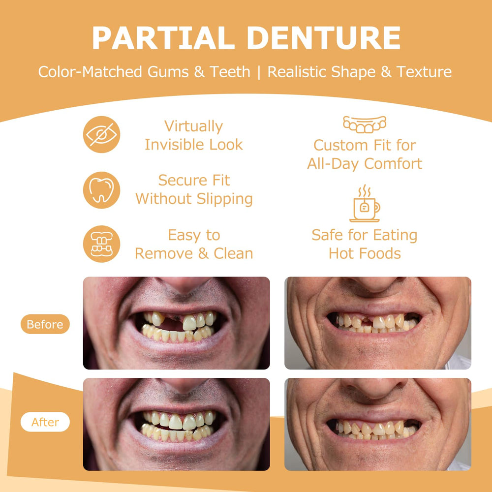 Flexible tooth options from 1 to 6 replacement teeth