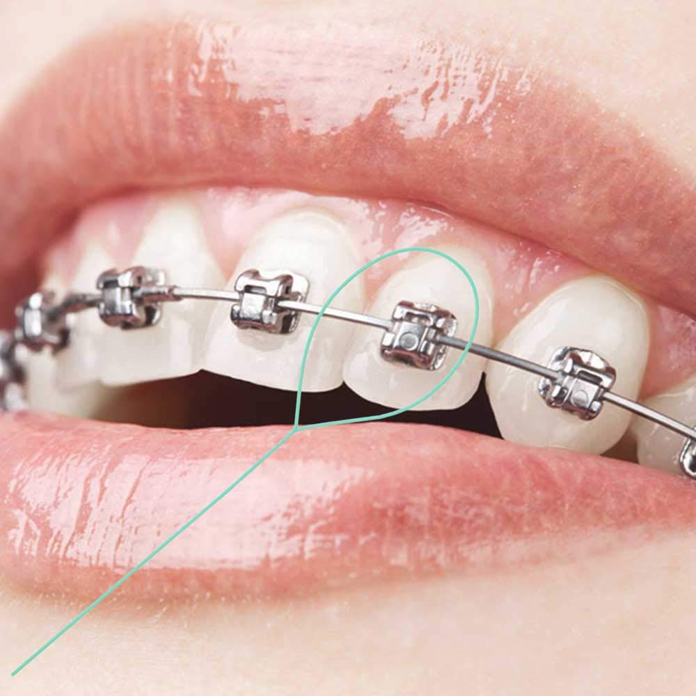 Packaging and contents of green floss threaders for dental care